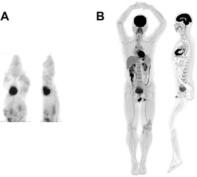 Total Body PET Imaging From Mice to Humans